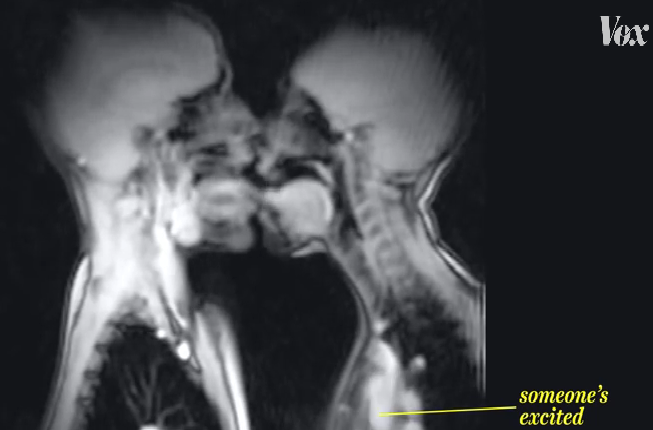 Mri Scanner Captures Sex And Much More What Various Activities Look