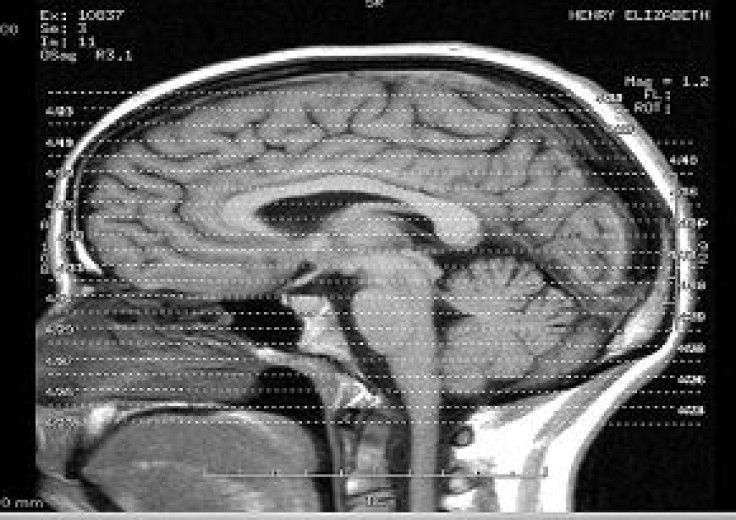 Brain