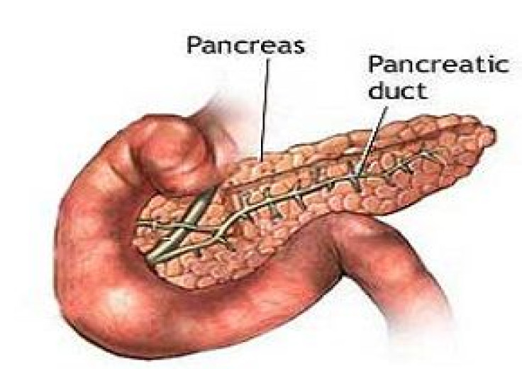 Less invasive techniques help manage complications of severe pancreatic disease