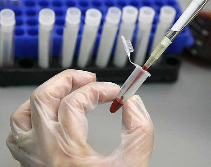 Sex, race, and geography influence health outcomes following primary HIV infection