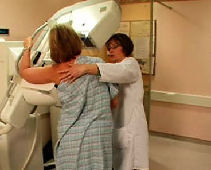 Yearly mammograms from age 40 save 71% more lives, study shows