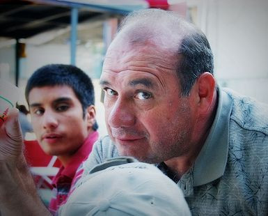 Losing hair at 20 is linked to increased risk of prostate cancer in later life