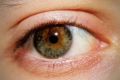 Drop in temperature may explain the increase in dry eye suffering