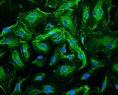 Scientists identify molecule that can increase blood flow in vascular disease