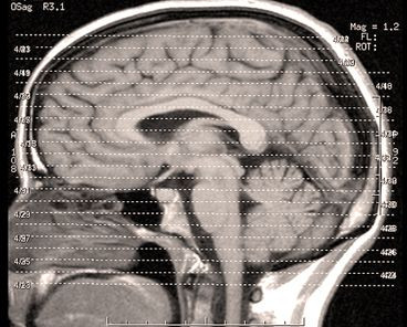 Rising star of brain found to regulate circadian rhythms