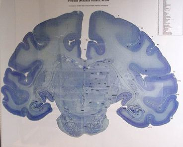Controlling brain circuits with light