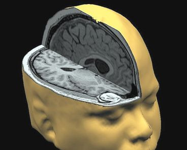 Surprising findings from studies of spontaneous brain activity