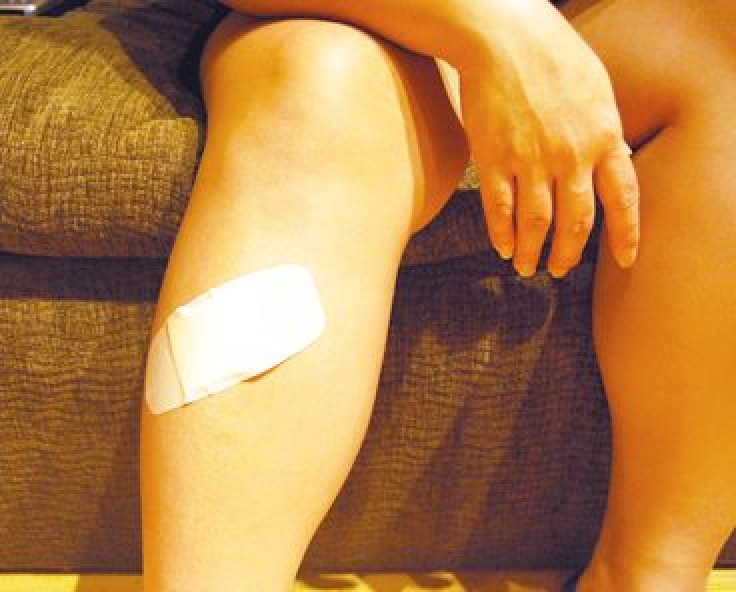 Artificial tissue promotes skin growth in wounds