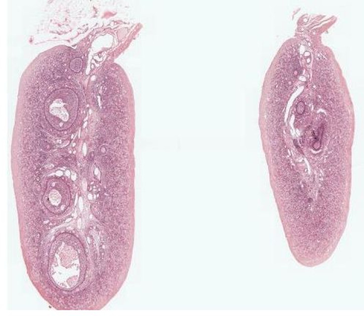 Ovulation