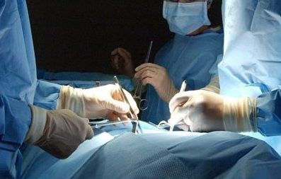Live Vasectomies
