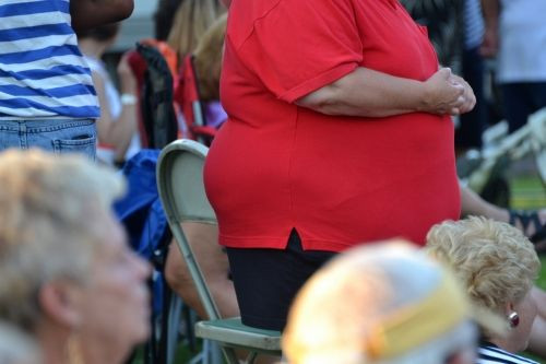 Obese woman