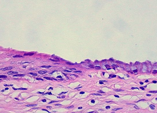 Cervix