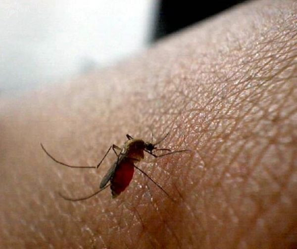 Mosquito Bites