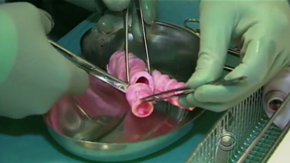 Synthetic Trachea