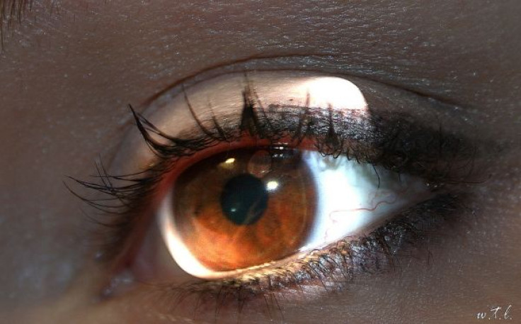 Eye Exam