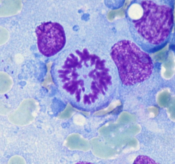 Mitosis In A Lymphoma Cell