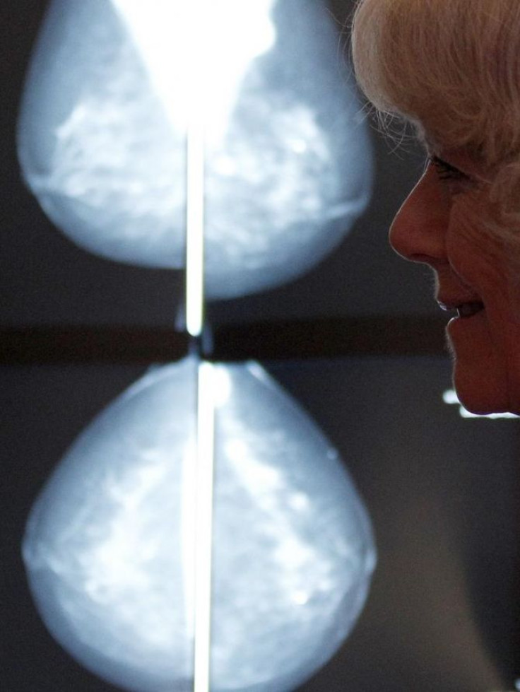 Britain's Camilla, Duchess of Cornwall (L) is shown a mammogram scanner during a visit to Nottingham Breast Institute in Nottingham, central England, January 25, 2011.