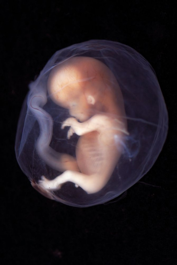 A nine to ten week old fetus in the womb.