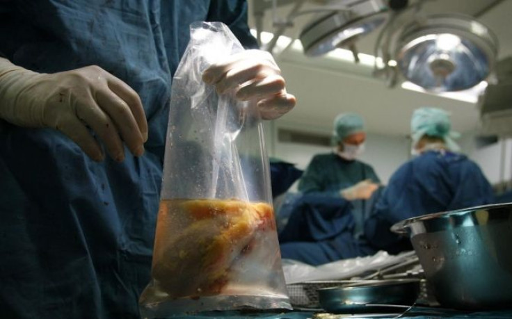 A surgeon holds a plastic bag containing a kidney after an operation
