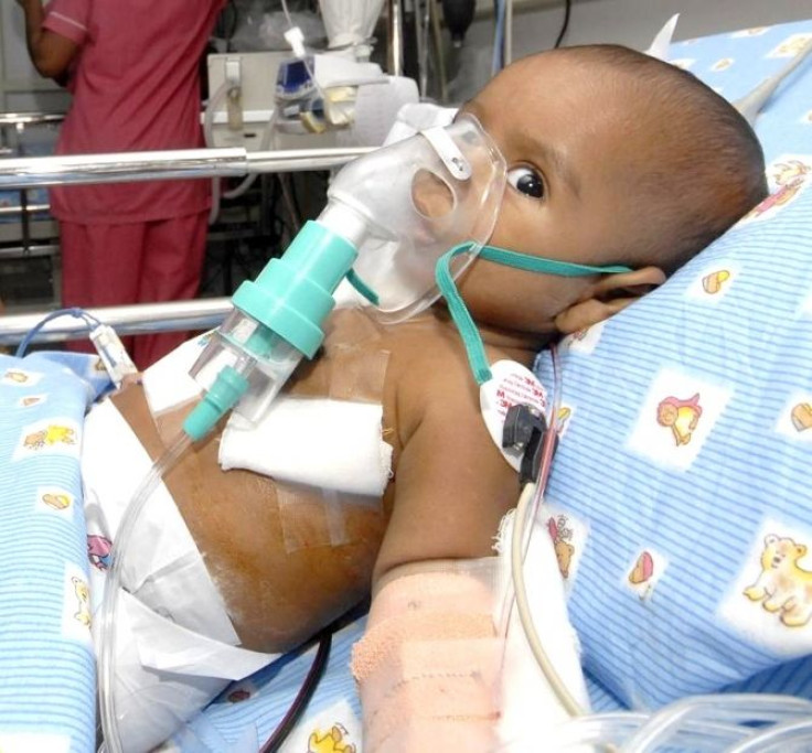 A six-month-old child lies in a hospital bed after his open heart surgery in a private hospital in Hyderabad