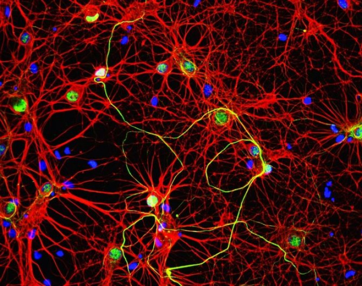 Alzheimer's disease travels through circuits from one brain cell to another.