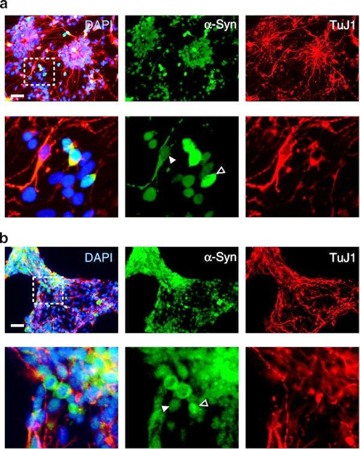 Parkinson's disease induced pluripotent stem cells.