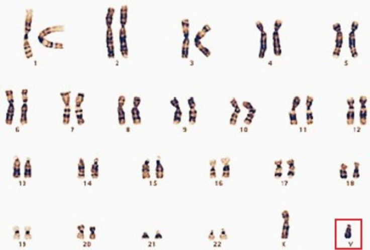 Male DNA contains an X and a Y chromosome.