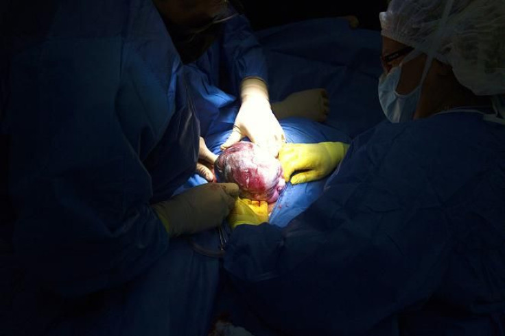 Doctors hold the head of a newborn baby during a caesarean section at the Santa Ana public maternity hospital in Caracas October 23, 2011.
