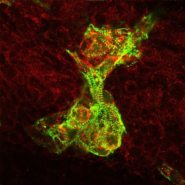 Heart muscle precursors derived from human embryonic stem cells.