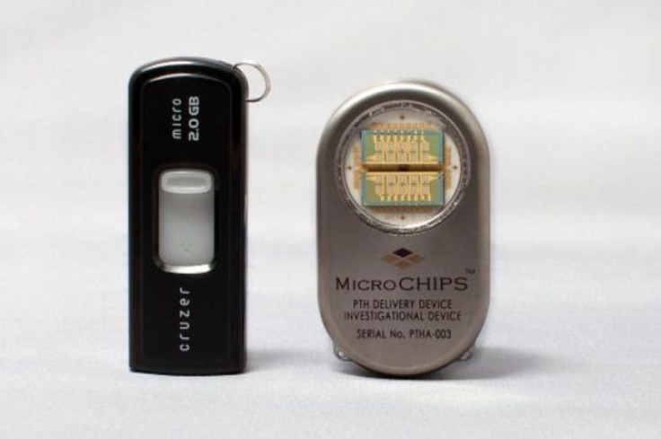 Implantable Chip