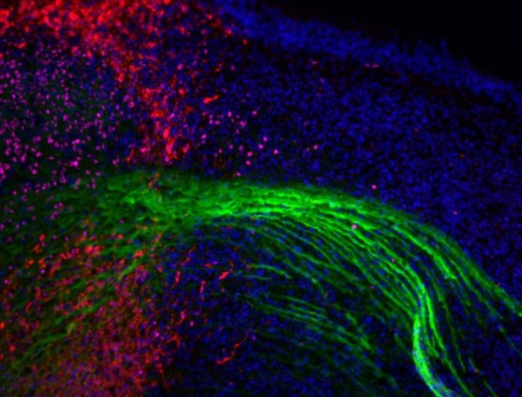 The axon bundles (green) of a mouse embryo.