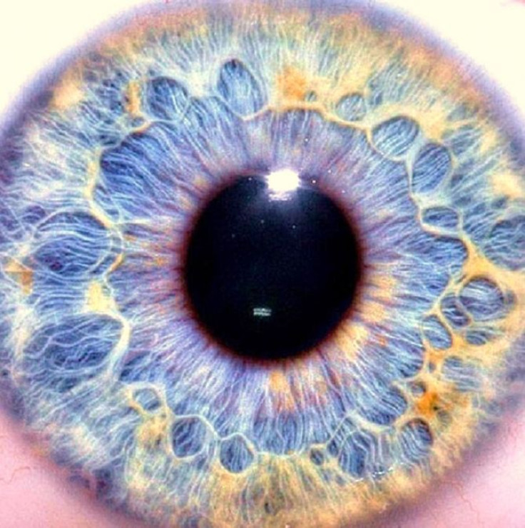 An Eye.