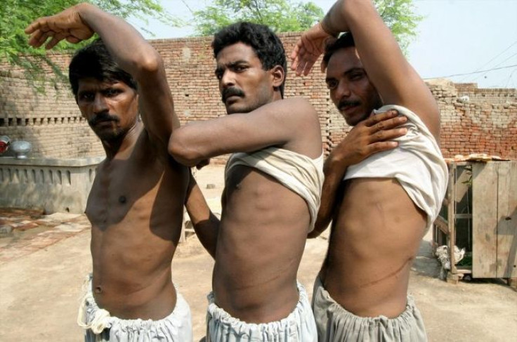 Mohammad Khalid (L), Mohammad Ijaz (C) and Liaqat show scars left on their bodies after they sold their kidneys