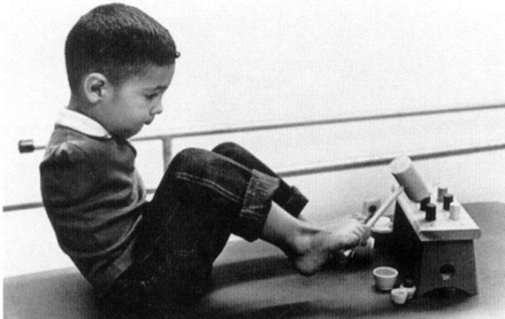 Thalidomide victim, Tony Melendez, is shown in an undated file photo at age four while attending a therapy program at the University of California