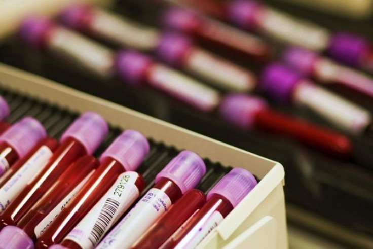 A new blood test may reveal whether patients are in imminent danger of having a heart arrack, according to a new study.