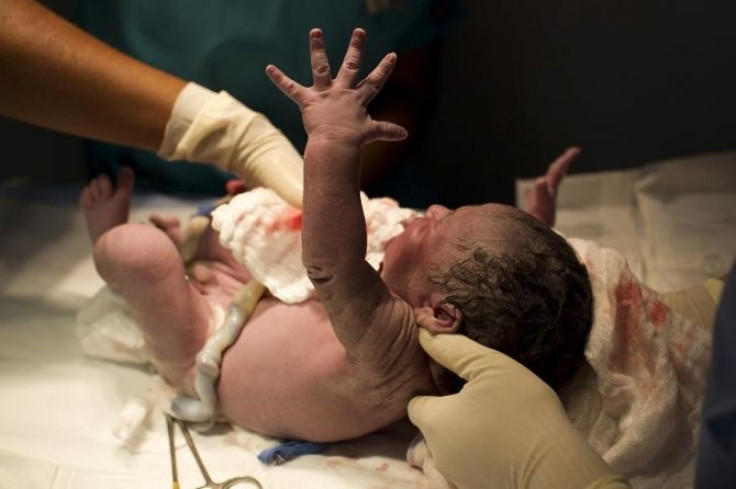 A newborn baby is being cleaned by doctors minutes after she was born inside the childbirth unit at private clinic in Caracas October 7, 2011.