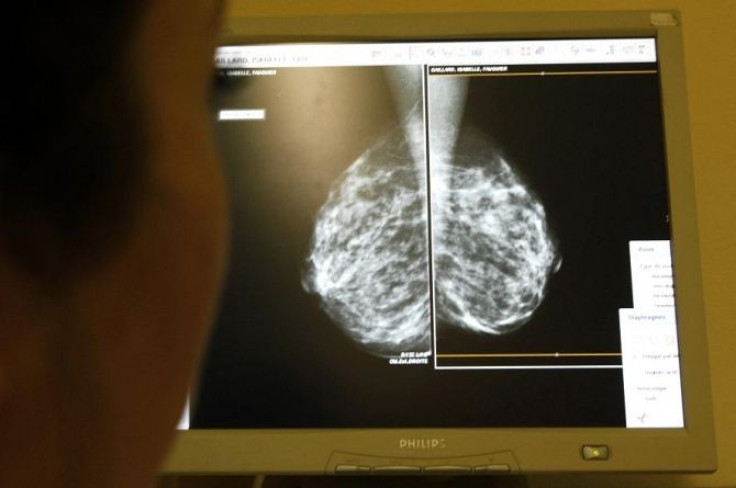woman undergoes a mammogram, breast cancer