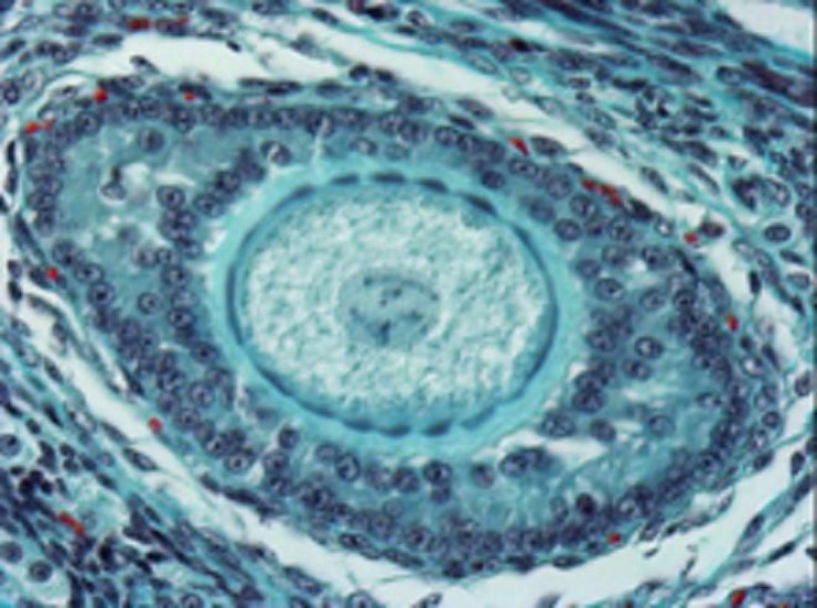 Microscopic view of the ovary showing the central egg surrounded by protective layers of cells.