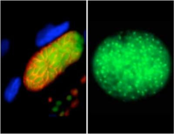 toxoplasma gondii parasite