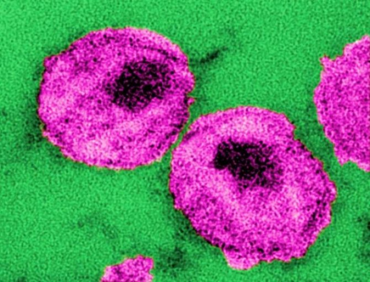 This thin-section transmission electron micrograph (TEM) depicted the ultrastructural details of a number of ”human immunodeficiency virus” (HIV) virus particles, or virions.