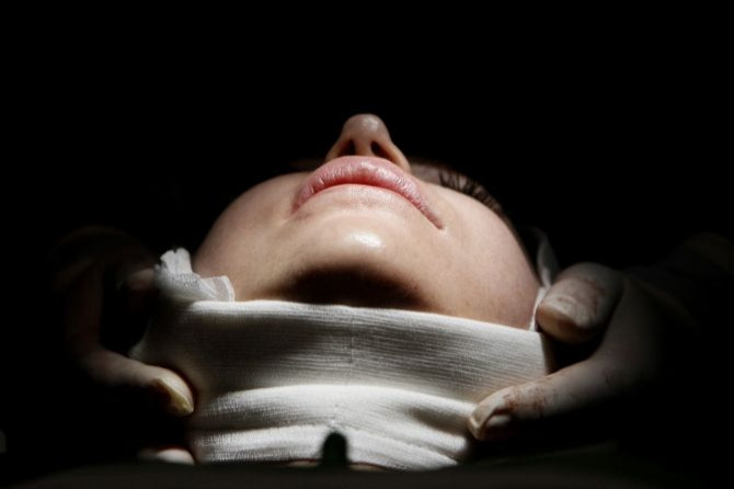 plastic surgery chin