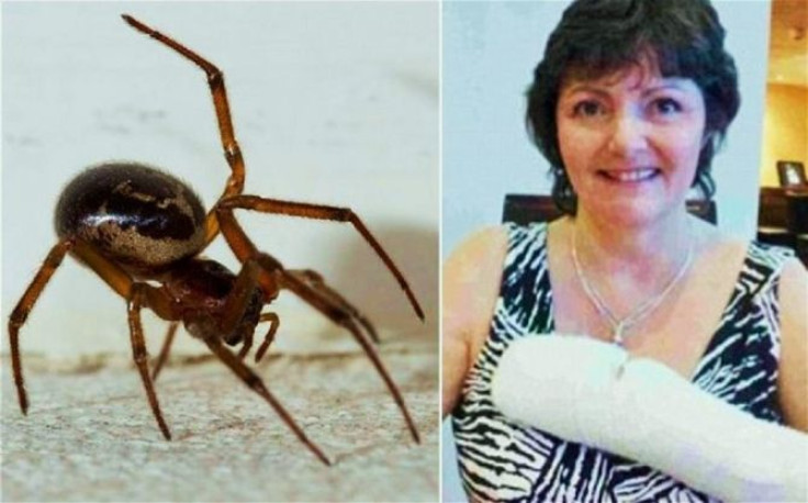 Doctors think that the false widow spider (Steatoda nobilis) was responsible for the bite on Catherine Coombs' arm.