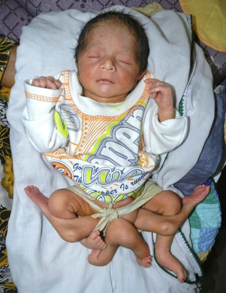 A newly-born child, who has six legs, rests on his grandmother's lap at his family home in Sukkur in Pakistan's Sindh province April 14, 2012.