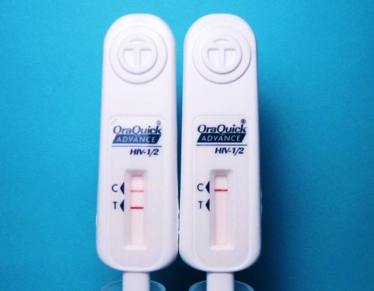The HIV test result is read directly from the OraQuick device.