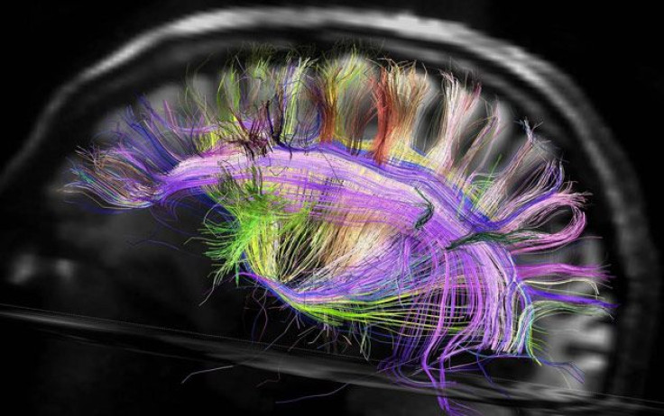 brain structure, wires