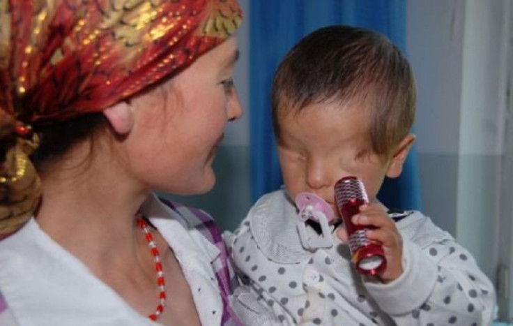 The boy was born with smooth skin in the sockets of where his eyes should have been, but since he was just eight months old, little Marwanijung has loved shining a flashlight at his face because he could still sense light.