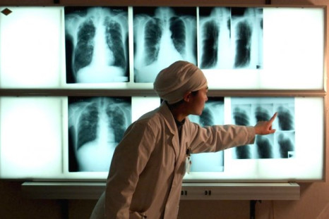 TB is usually confirmed by an X-ray of the lungs after a positive skin test in Americans. People who are vaccinated in other parts of the world always test positive by skin test.