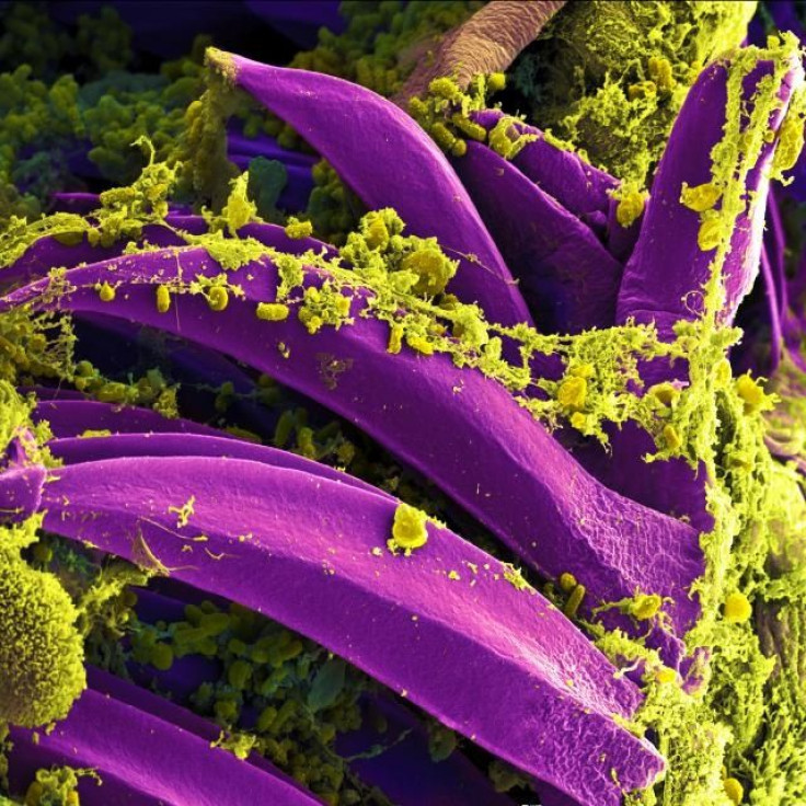 Scanning electron micrograph of Yersinia pestis, which causes bubonic plague, on proventricular spines of a Xenopsylla cheopis flea.