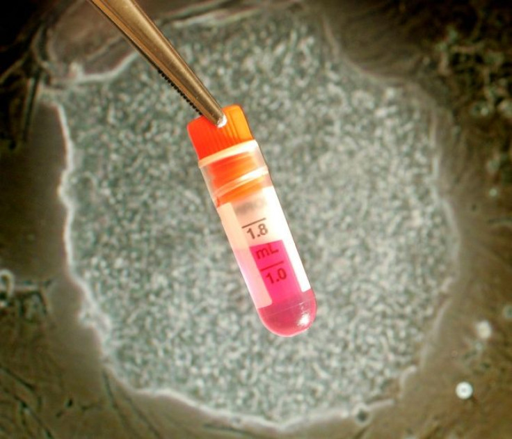 An ampoule containing a medium for stem cell storage is displayed in front of a microscopic photograph showing a human embryonic stem cell at the UK Stem Cell Bank in north London, May 19, 2004. The world's first embryonic stem cell bank opened in Britai