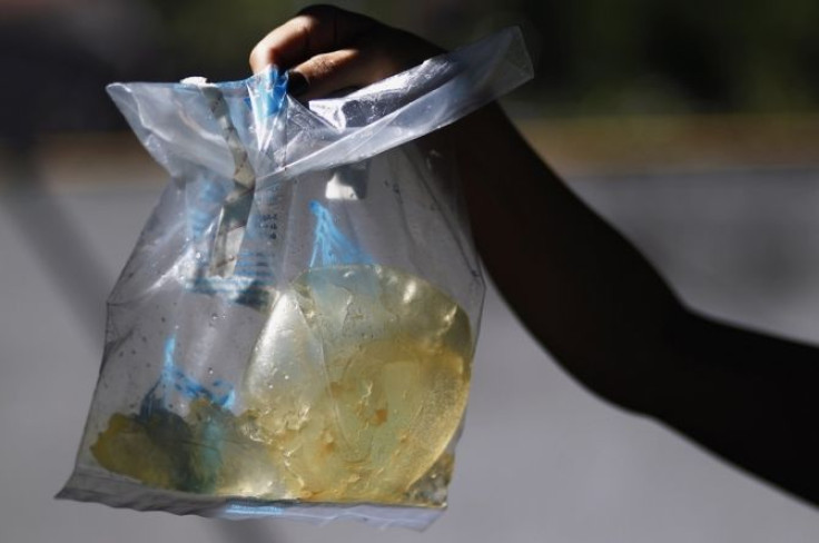 Claudia Rolon holds a bag with the defective silicone gel breast implant manufactured by the now-defunct French company Poly Implant Prothese (PIP) that she had to have removed, during an interview with Reuters at her home in La Matanza, on the outskirts